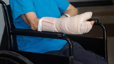 broken bone car accident