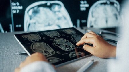 traumatic brain injury