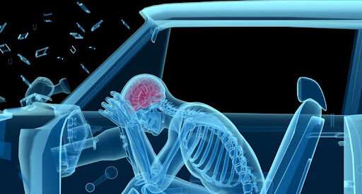 Severity of Head Injuries in Car Accidents